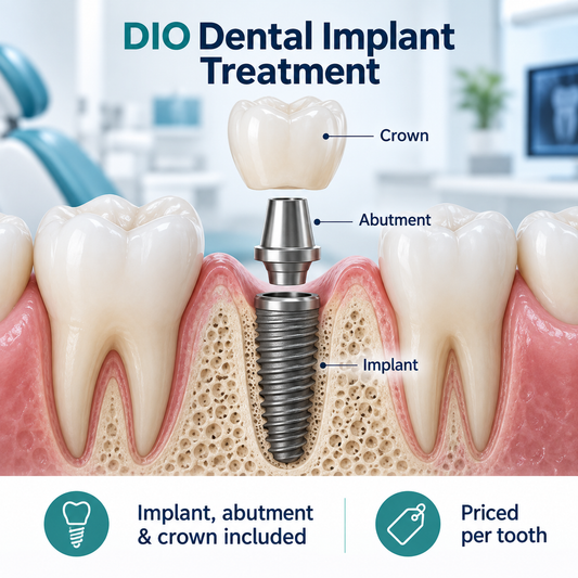 DIO Dental Implant Treatment in China