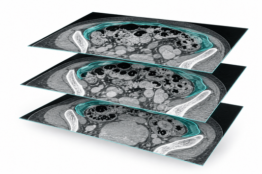 AI-generated conceptual abdominal imaging planes for a study on peritoneal metastasis detection.
