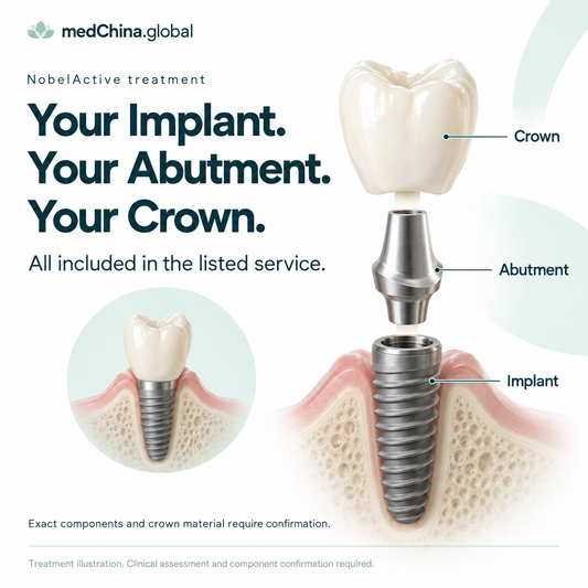 NobelActive treatment: three components. Generic treatment illustration; clinical assessment and component confirmation required.