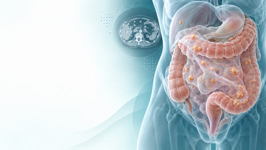 AI-generated educational illustration of peritoneal metastasis and abdominal imaging; not a patient scan.