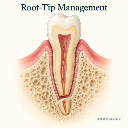 Root-tip management is distinguished from the rest of the tooth. Educational illustration.