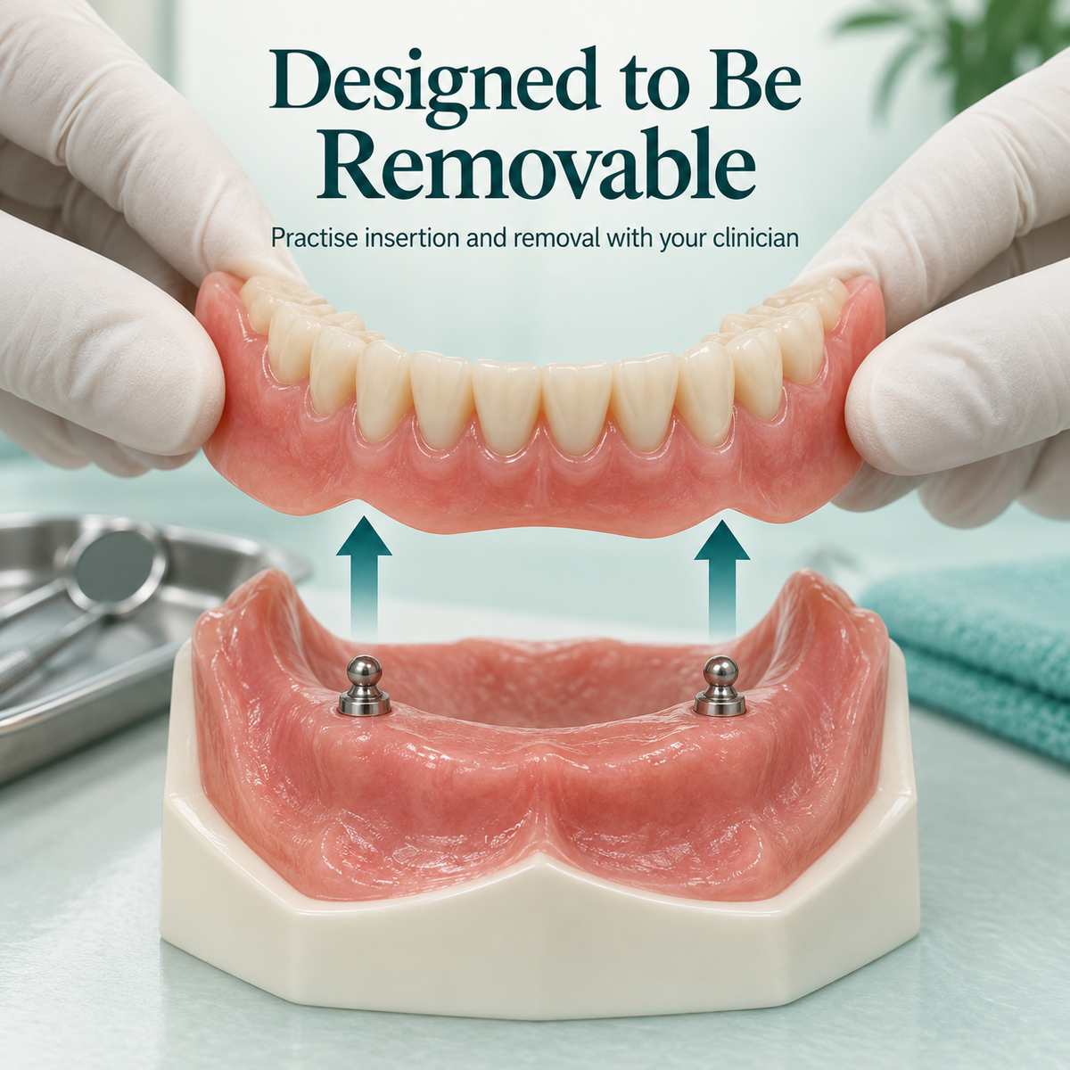 Demonstration of lifting a removable denture off two ball anchors. Educational illustration.