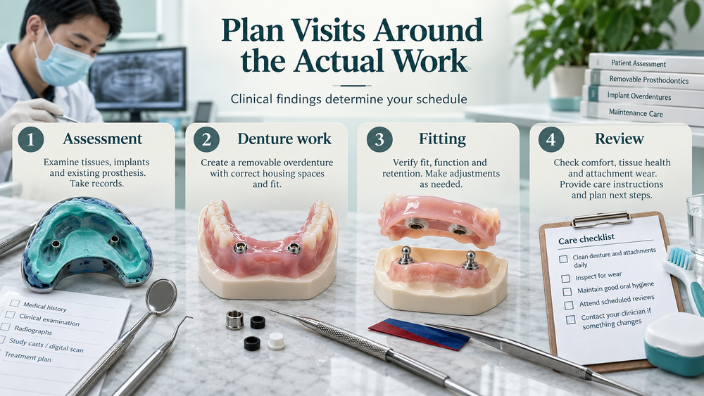 Wide appointment sequence for overdenture assessment, fabrication, fitting and review. Educational illustration.