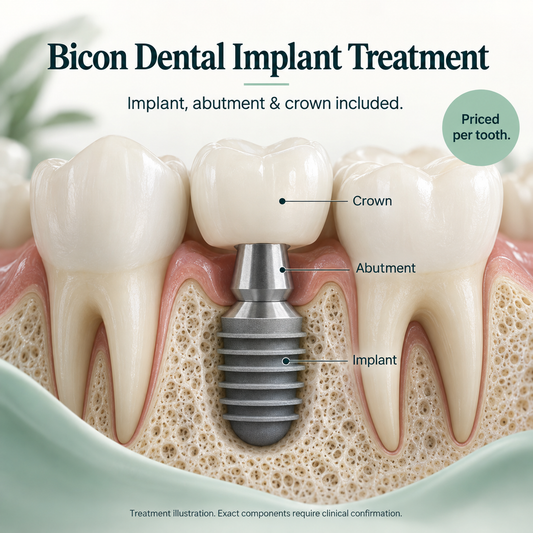 Bicon implant treatment illustration: overview. Exact components require clinical confirmation.