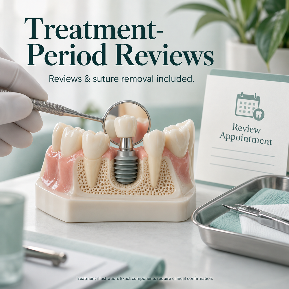 Educational Bicon treatment illustration. Exact components require clinical confirmation.