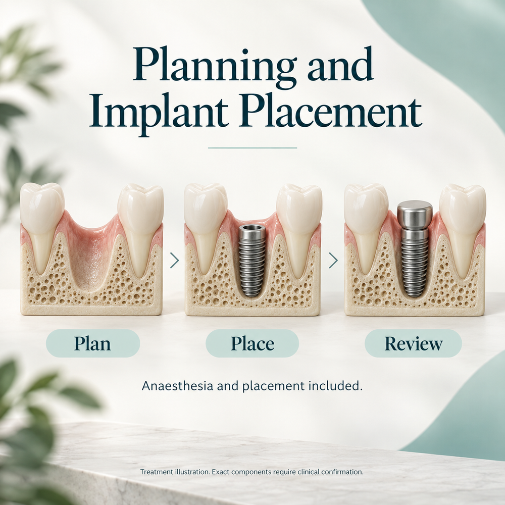Educational Lance treatment illustration. Exact components require clinical confirmation.