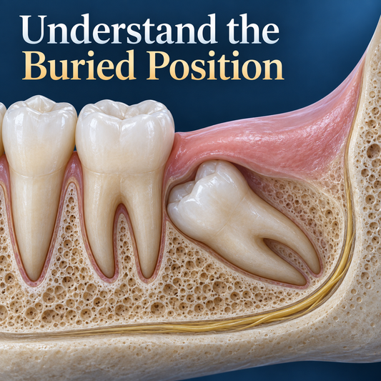 Understand the Buried Position. Educational illustration.