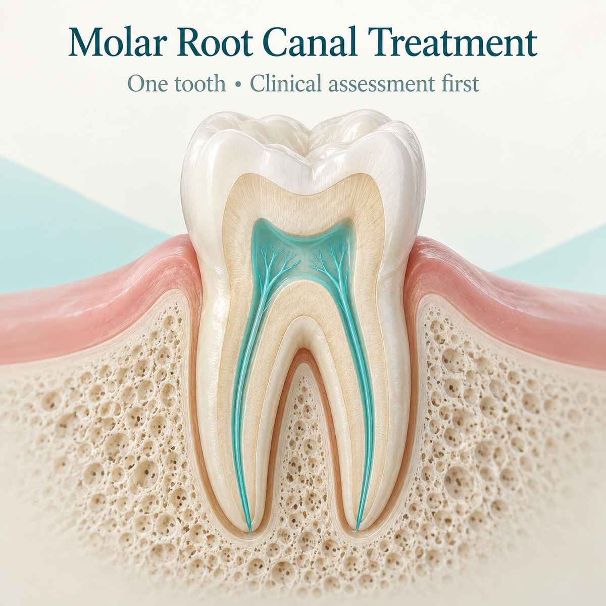 Root canal care inside a first or second molar. Educational illustration.