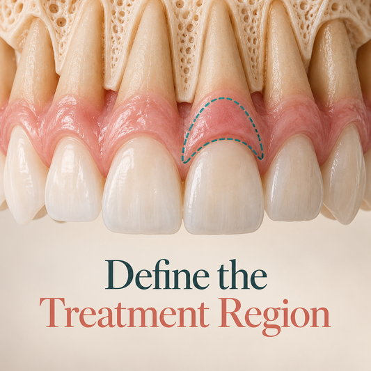 Define the Treatment Region. Educational illustration.
