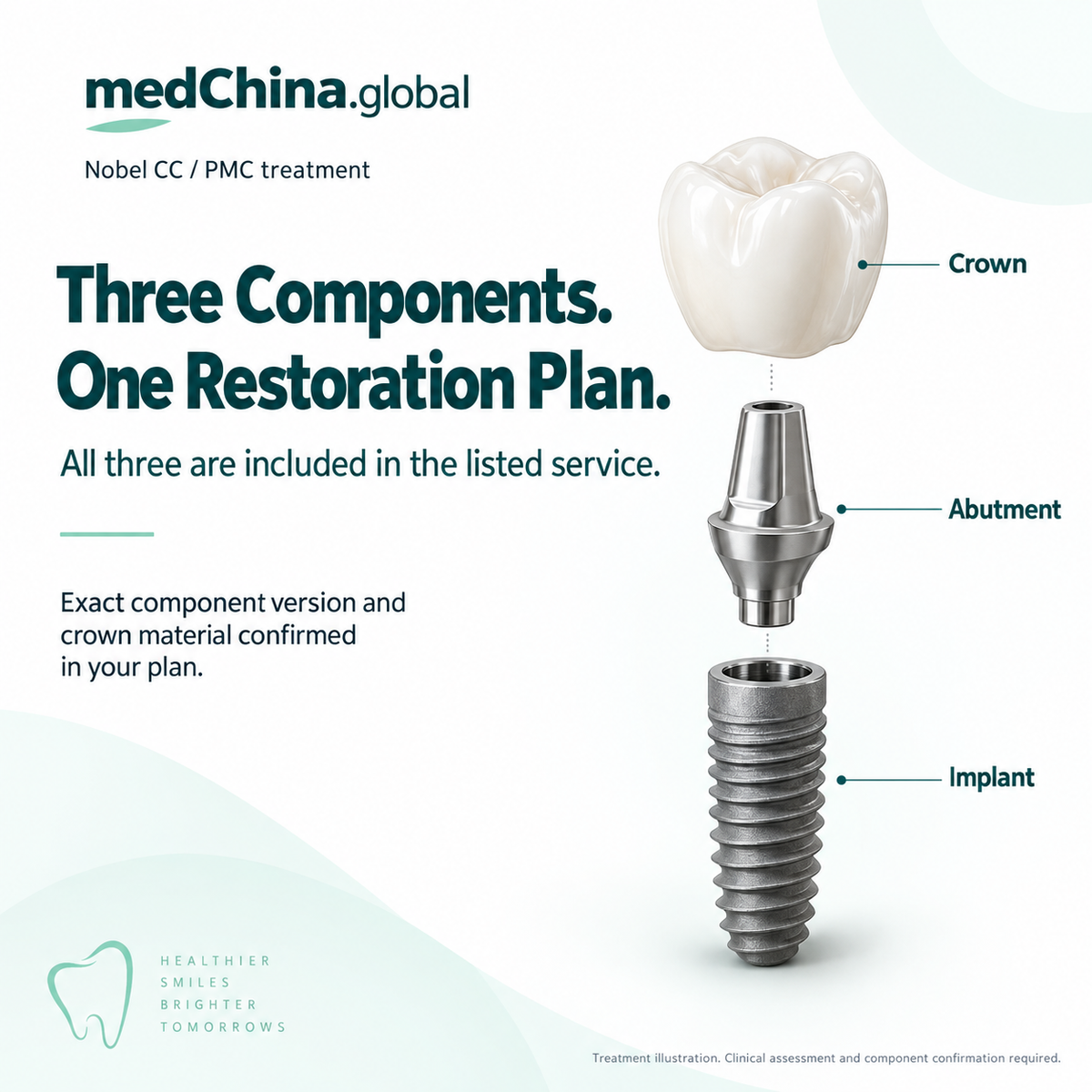 Nobel CC / PMC treatment: components. Educational illustration; clinical assessment and exact components require confirmation.