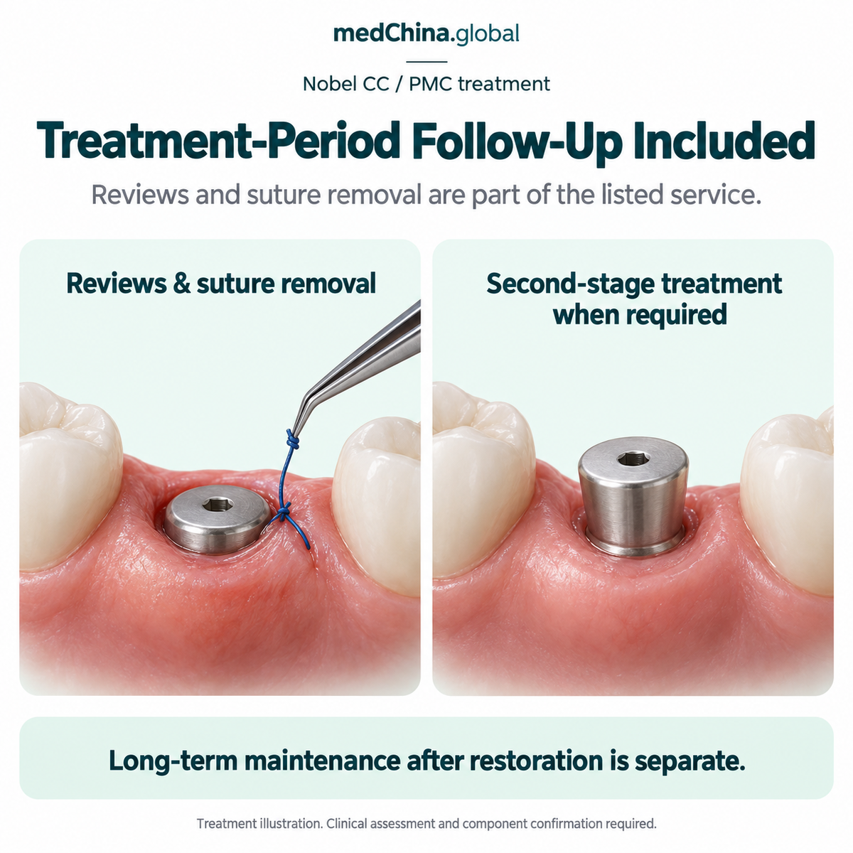 Nobel CC / PMC treatment: reviews. Educational illustration; clinical assessment and exact components require confirmation.