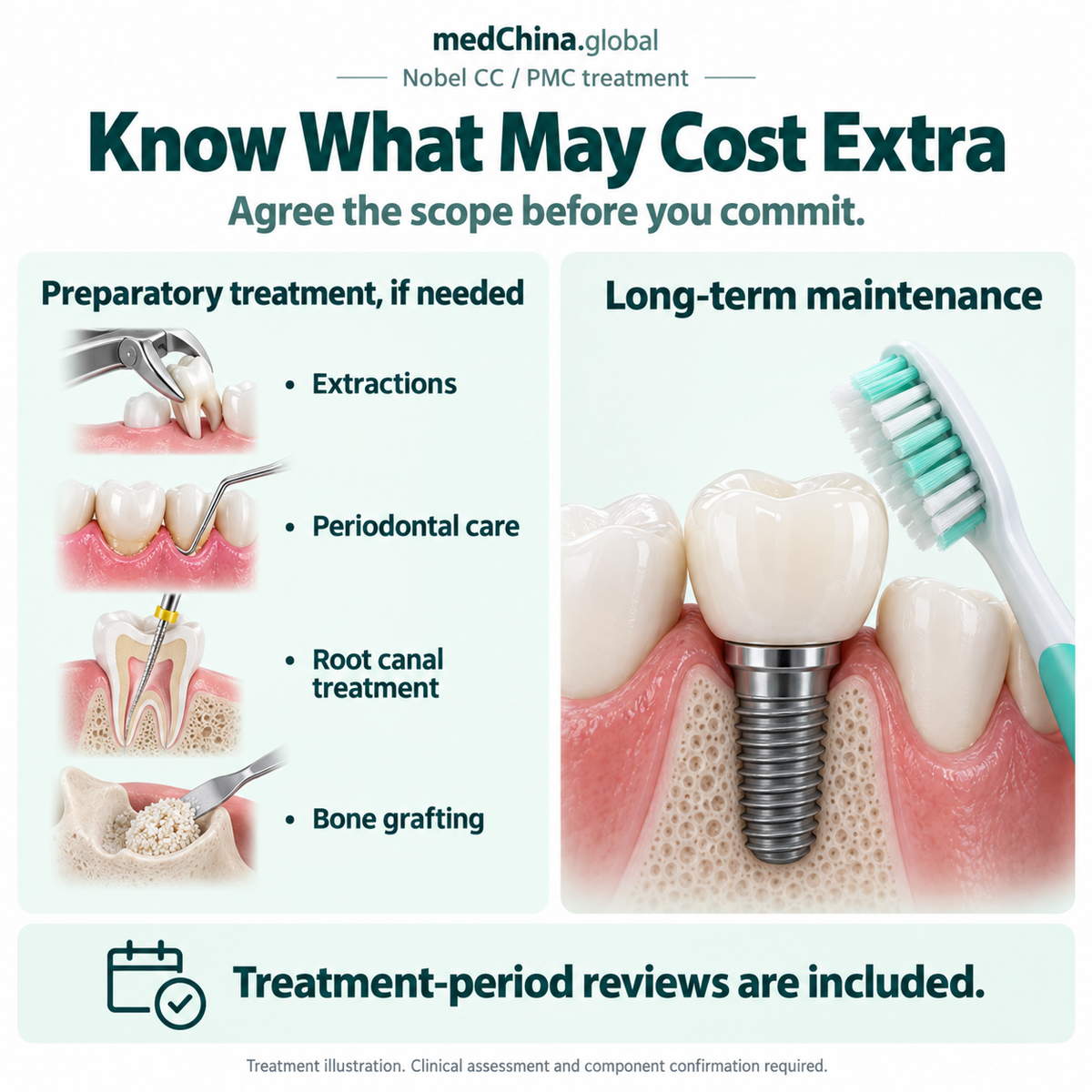 Nobel CC / PMC treatment: costs. Educational illustration; clinical assessment and exact components require confirmation.