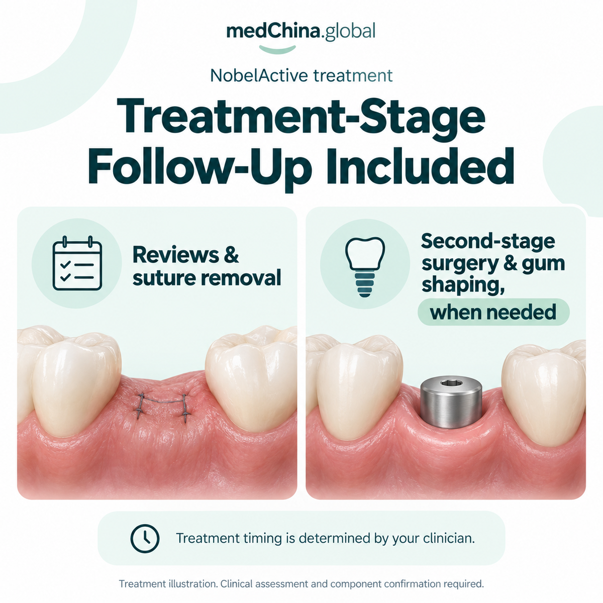 NobelActive treatment: treatment follow up. Generic treatment illustration; clinical assessment and component confirmation required.