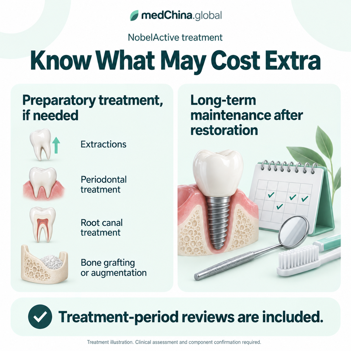 NobelActive treatment: separate costs. Generic treatment illustration; clinical assessment and component confirmation required.