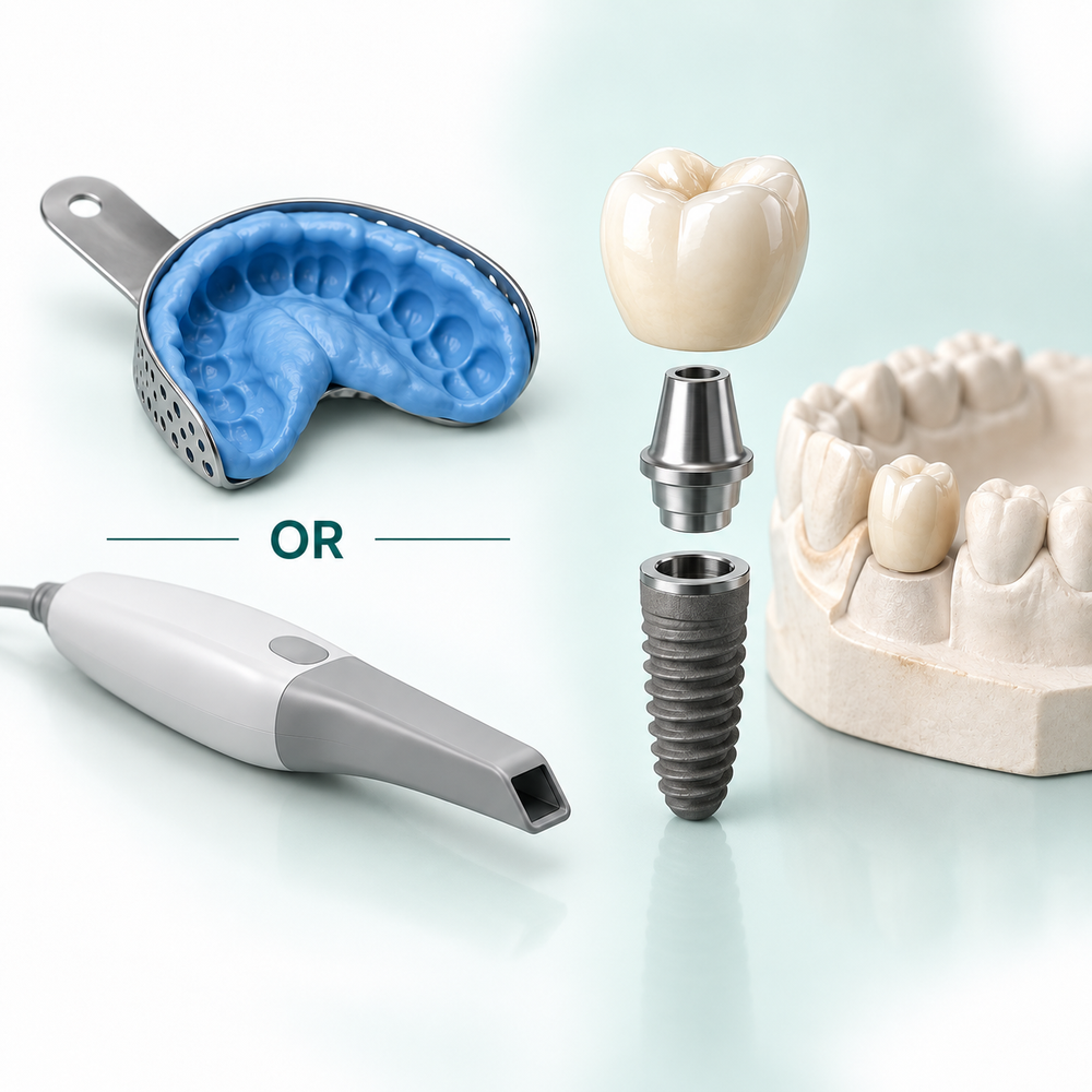 Illustrative impression tray or intraoral scanner, crown and abutment components, and fabrication model.