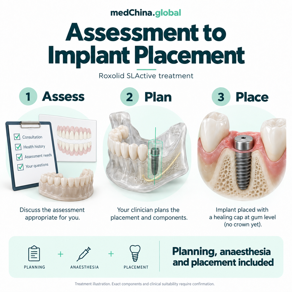 Educational Roxolid SLActive treatment illustration; exact components require clinical confirmation.