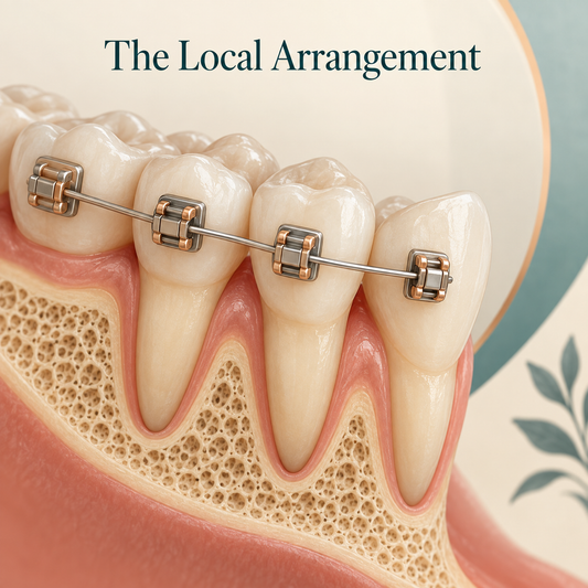 The local arrangement depends on the prescription. Educational illustration.