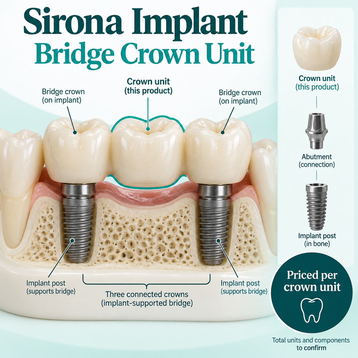 One crown unit is highlighted within a connected implant-supported bridge. Educational illustration.