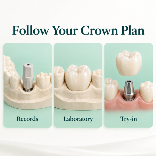 Records, fabrication and try-in form distinct crown stages. Educational illustration.