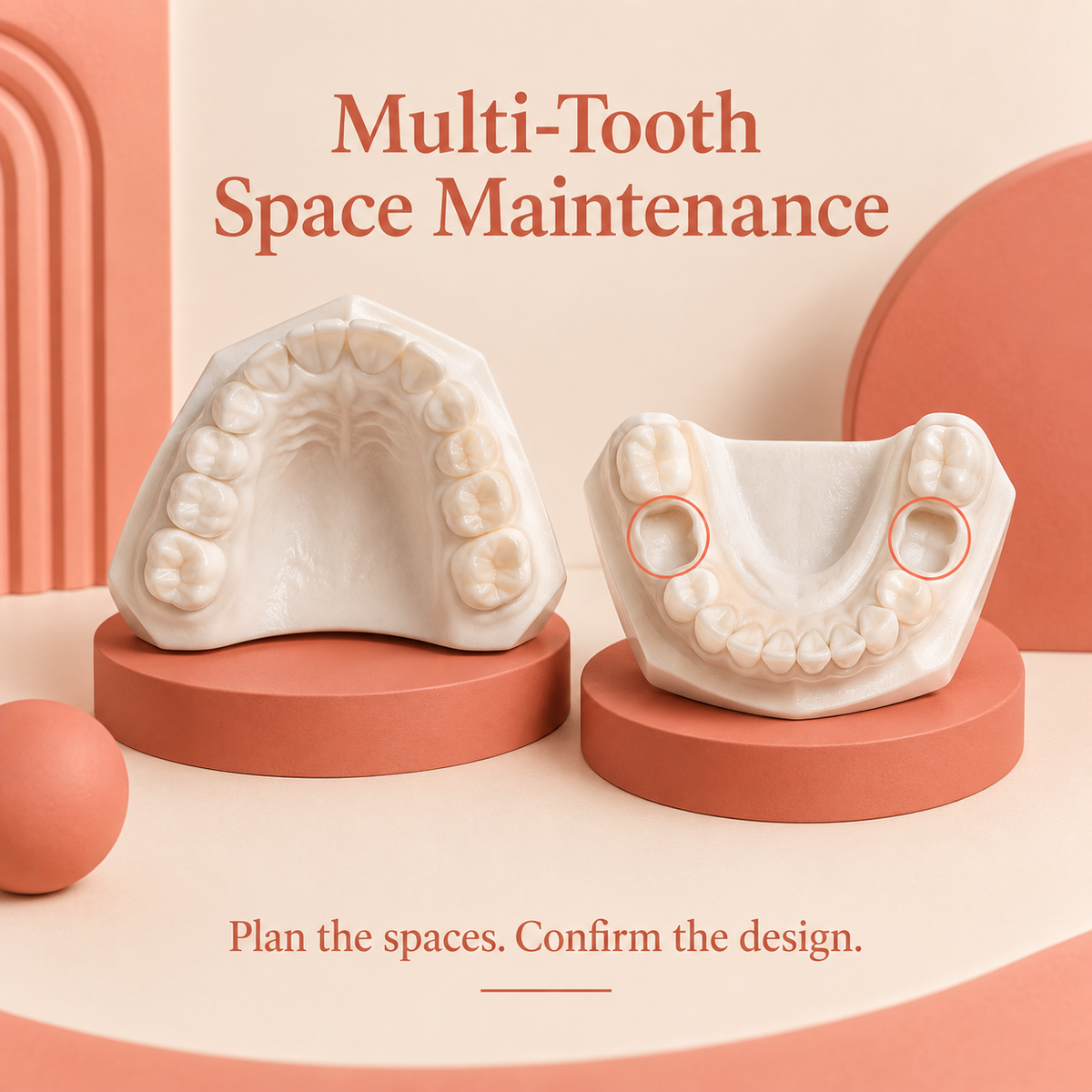 A teaching model highlights spaces after early primary-tooth loss. Educational illustration.