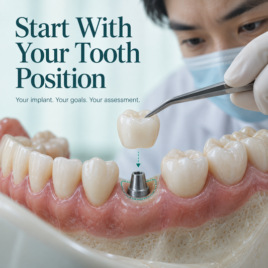 One planned crown site highlighted in a partial dental arch model. Educational illustration.